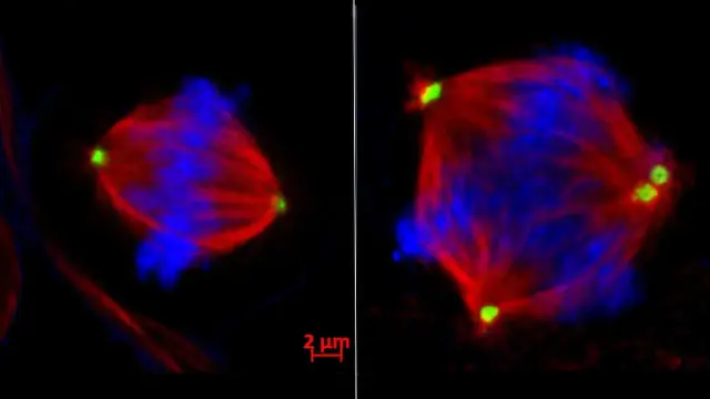 Un enzima chiamato EZH2 decide quali cellule tumorali diventeranno metastasi. Non modifica il DNA direttamente: lo avvolge, silenziando i geni che mantengono l'ordine nella divisione cellulare. Il 5% delle cellule del tumore triplo negativo usa questo meccanismo per viaggiare. La buona notizia? Esistono farmaci che bloccano EZH2 e sono già stati approvati.