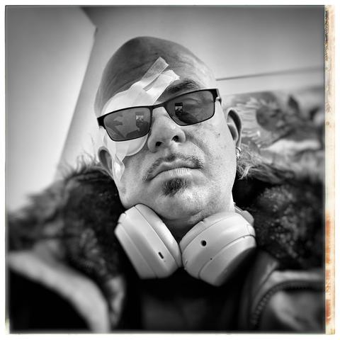 A close-up, black-and-white photo of a person with a shaved head wearing dark sunglasses. Their right eye is covered with a medical bandage secured by surgical tape. The person has a pencil beard and a soul patch and is wearing over-ear headphones around their neck. They appear to be dressed warmly in a thick, fur-lined jacket. The background is out of focus but hints at an indoor setting, possibly with artwork or a decorative element behind them.
