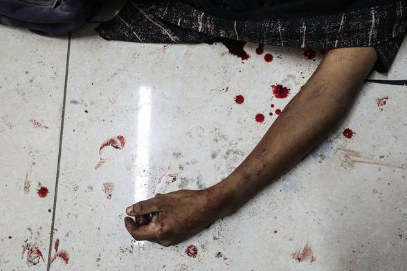 El cuerpo de un adolescente muerto en un ataque de Israel, en el Hospital al-Awda para su entierro en la ciudad de Gaza, el 19 de septiembre de 2025. (Moiz Salhi / Anadolu via Getty Images)