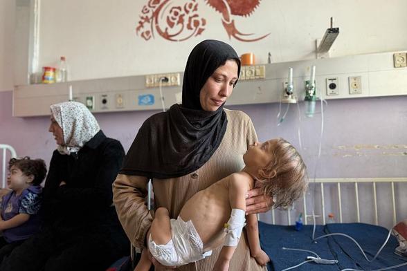 Mera Hatim Abu Verde, de cuatro años, se encuentra en estado crítico debido a la desnutrición en el Hospital de los Mártires de Al-Aqsa en Deir al-Balah, Gaza, el 2 de octubre de 2025. (Alaa Y. M. Abumohsen / Anadolu via Getty Images)