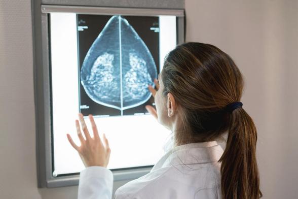 Una doctora revisa las placas de una mamografía, en una imagen de archivo. (Getty Images)