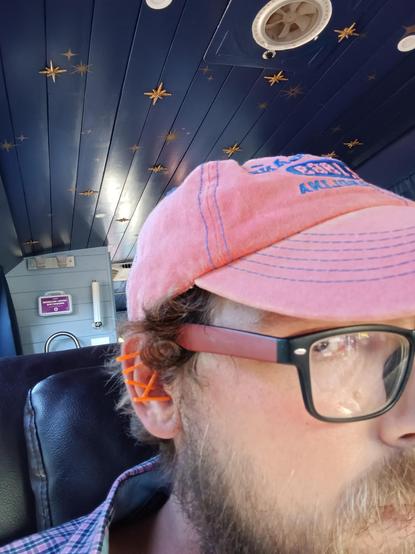 Me with black and red glasses and an orange hat with 5 acupuncture needles sticking out of my ear. I'm in a leather chair and a school bus ceiling with night time like painting and stars.