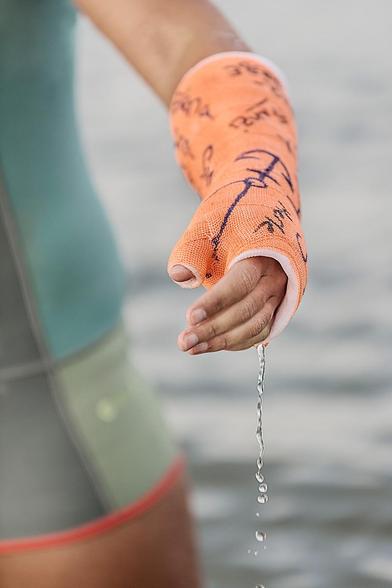 Ein Arm mit einem orangefarbenen Gipsverband, der mit schwarzen Unterschriften und Zeichnungen versehen ist. Die Hand ist leicht geöffnet, und Wasser fließt aus dem Gips. Im Hintergrund ist unscharf Wasser zu sehen. Die Person trägt einen eng anliegenden, mehrfarbigen Neoprenanzug.