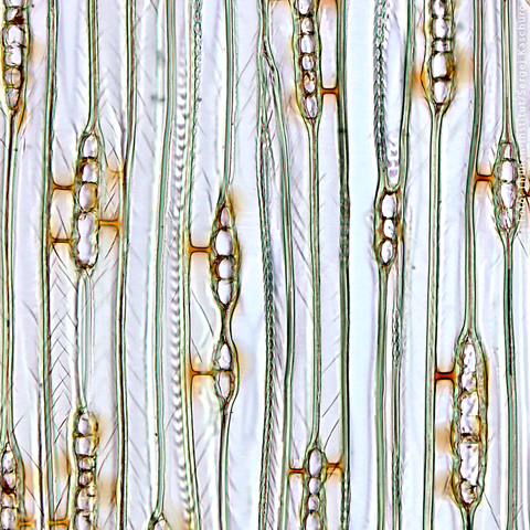 Mikroskopische Aufnahme von länglichen, durchsichtigen Zellen mit kugelförmigen Strukturen und braunen Verbindungsstellen.