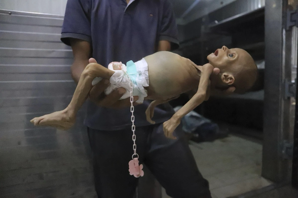 The corpse of a Palestinian child starved to death by Netanyahu’s Israel