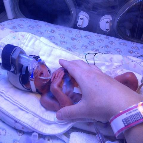 Photo of a tiny premature baby in an incubator. He is a newborn — 15 weeks early, weighing 700g.