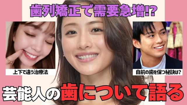 【有益2ch】歯列矯正で需要が急増した芸能人！芸能人の歯について語りたい【ガルちゃん】