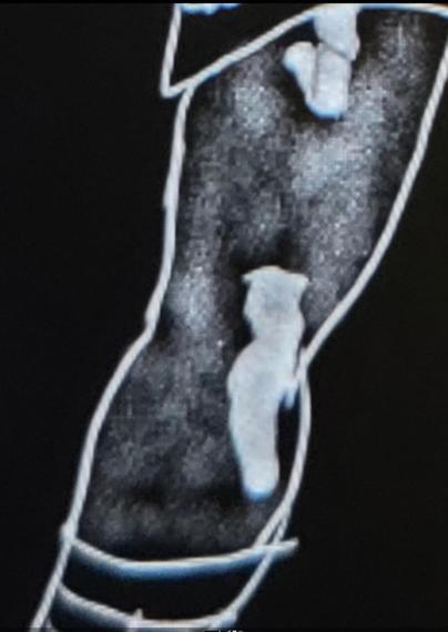 Black and white drawing of a leg in torn hose and a bit of a skirt.