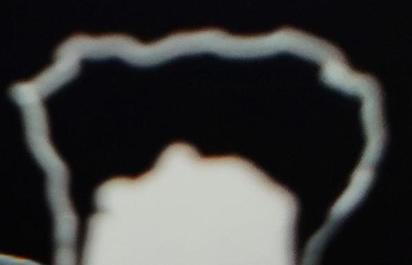 A blurry photo of a black and white sketch of a forehead with broccoli hair.