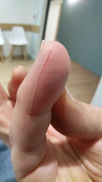 Oriculaire en gros plan avec une grande entaille sur toute la longueur de la dernière phalange