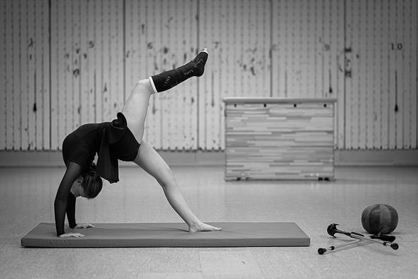 Eine 15-jährige Turnerin führt eine Brücke mit einem Bein in der Luft aus. Sie trägt einen schwarzen Unterschenkelgips am rechten Bein, während ihr linkes Bein barfuß auf dem Boden steht. Sie ist auf einer Matte in einer Turnhalle, im Hintergrund ist eine Holzwand mit einer Turnbank zu sehen. Rechts neben der Matte liegen zwei Krücken und ein Medizinball auf dem Boden.