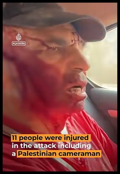 Screenshot from somewhere in https://youtube.com/watch?v=k13vpTiEWWs

A Palestinian man with blood on his face in a car.

Text visible: "11 people were injured in the attack including a Palestinian cameraman"

At the top left the AlJazeera logo.

Thanks to https://aljazeera.com for showing the world the atrocities committed by Israeli subhumans.