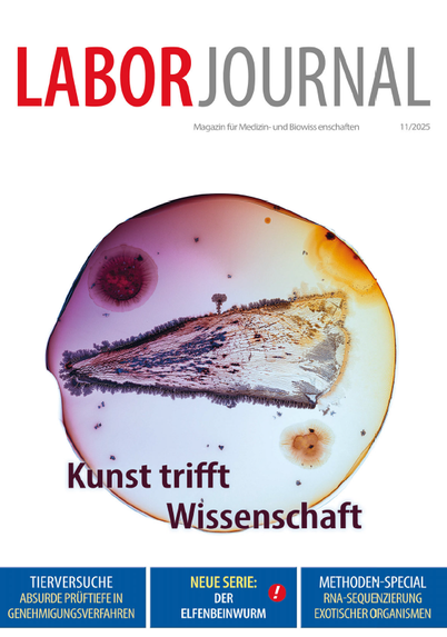 Titelblatt der neuen Laborjournal-Ausgabe 11/2025. Zu sehen ist eine eingefäbte und mikroskopisch vergrößerte Pflanzenzelle in einem Tropfen. Im unteren Drittel steht das Titelthema "Kunst trifft Wissenschaft".Ganz unten in drei blauen Kästen nebeneinander stehen Ankündigungen von drei weiteren Artikelthemen des abgebildeten Hefts.