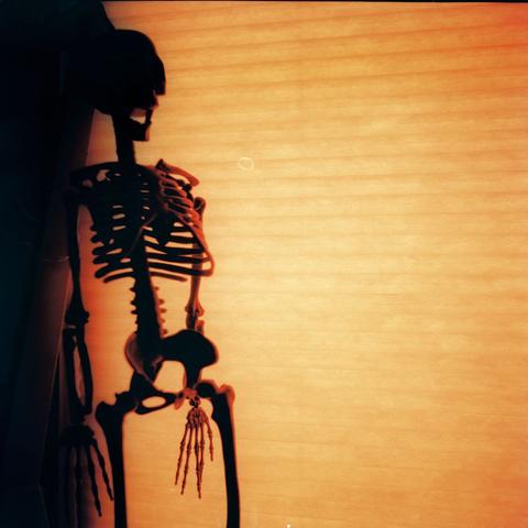 Redscale image of a backlit plastic skeleton hanging in front of accordion blinded window. A visible water drop looking blemish is near the center of the image that I suspect is a lab defect.