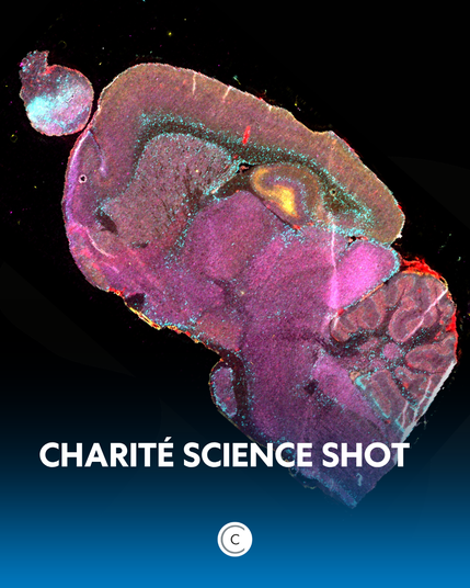 Hirngewebe, das größtenteils pink angefärbt ist. Zusätzlich sind in bestimmten Bereichen türkisfarbene, rote und gelbe kleine Punkte zu sehen. © Charité | Luis Hummel