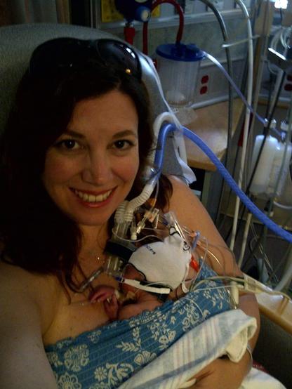 A tiny premature baby, weighing less than two pounds, is tucked down his mama's shirt, along with all the tubes and wires that keep him alive in the NICU.