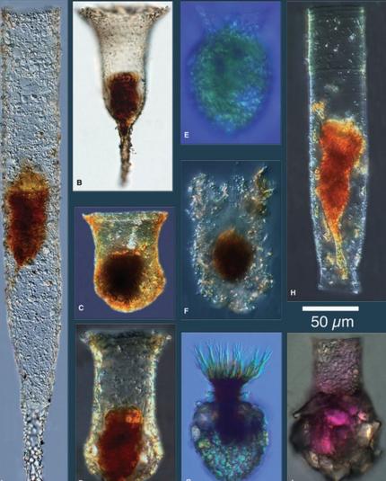 image/jpeg a collection of microscopic photos of organisms with a wide diversity of vase-shaped shells. Colour ranges from yellow to red to purple. A size bar indicates they are about 50 microns in width but can be many times longer. Taken from Dolan et al. 2013. 
https://www.wiley.com/en-us/The+Biology+and+Ecology+of+Tintinnid+Ciliates%3A+Models+for+Marine+Plankton-p-9780470671511