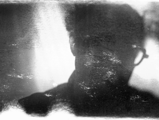 A badly damage black and white photograph of a person’s head, little is clear but enough that we recognize a human form with hair, an ear, glasses, collar, and shoulders.