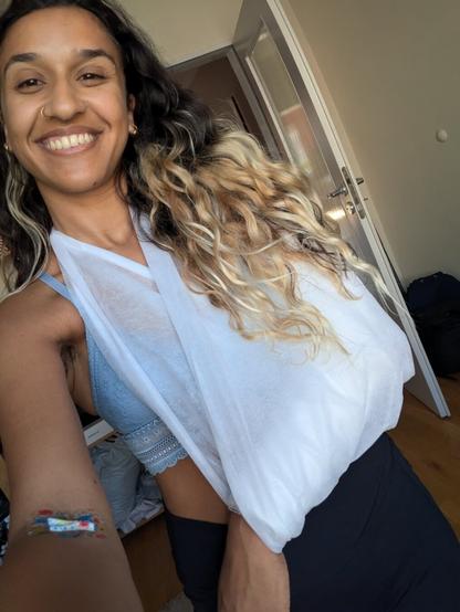 A woman with an arm cast