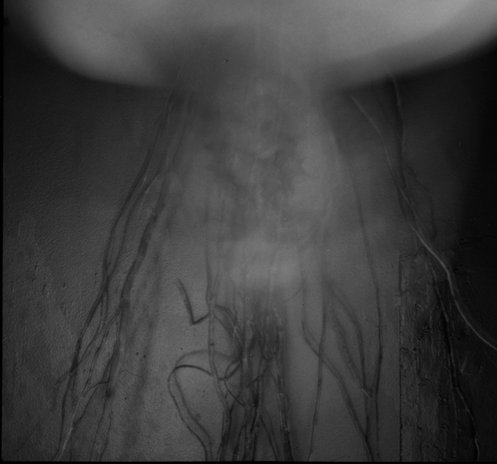 black and white selfportrait on film. a double exposer with plants.