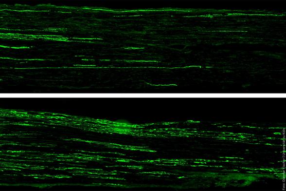 Zwei Aufnahmen von Nervenfasern, zeigen grüne fluoreszierende Strukturen auf schwarzem Hintergrund.