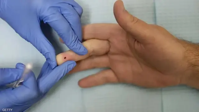 صحيفة المرصد - شفاء رجل في النرويج من فيروس الإيدز .. والكشف عن طريقة علاجه