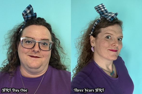 A side-by-side timeline of two pictures of Miriam.  The first is labelled "HRT Day One" and the latter labelled "Three Years HRT."  Despite wearing the same shirt and the same ridiculous hair bow, she looks like two unrelated people.