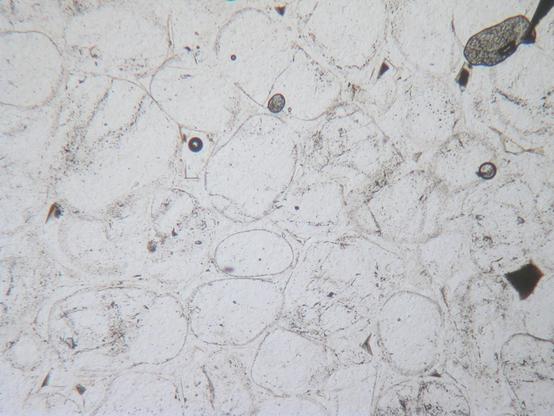 A view of a rock thin section using plane polarized light under a polarizing microscope. Almost all the image is made of a clear, transparent mineral, with faint ghostly outlines of rounded grains visible within it. There are some darker bubbles in the section which "stand out" from the background - these are an artefact of sample preparation.