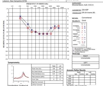 Sample of audiological evaluation showing a graph with blue (left) and red (right) hearing at different frequencies and dB levels.