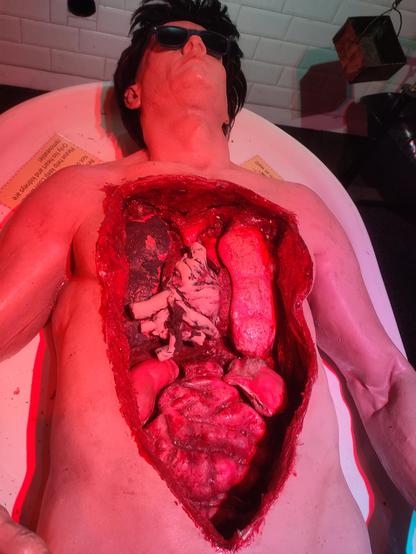 A dummy with the chest and abdomen cut open to reveal the organs inside.