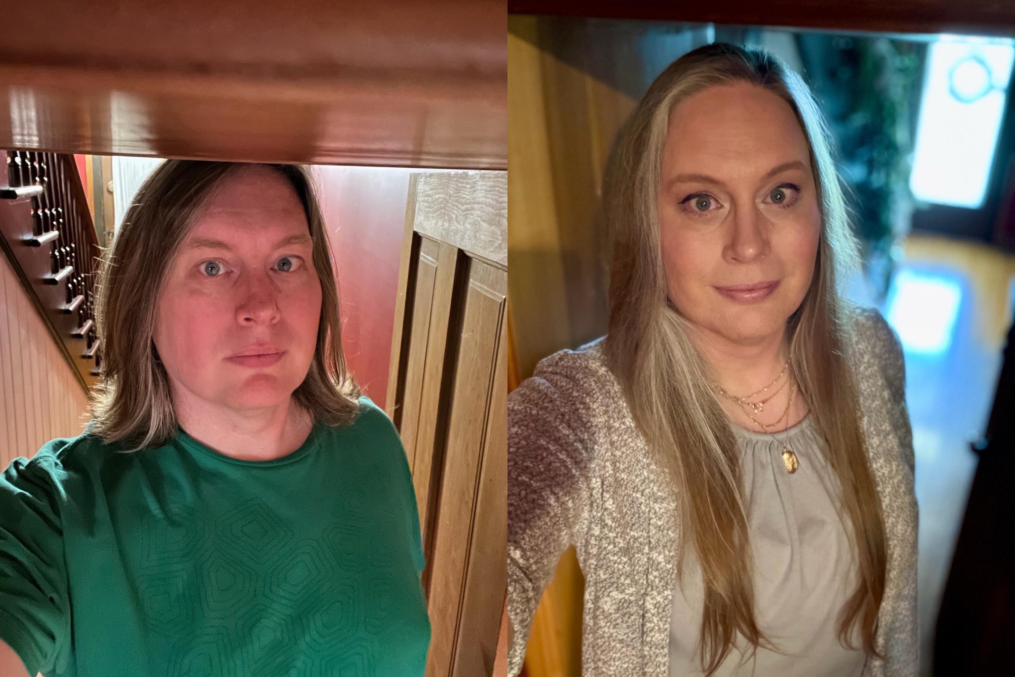 Side by side selfies from 2021 vs 2026 showing approximately 2 inches of height loss.