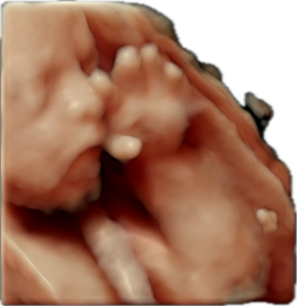 ultrasound of baby under construction