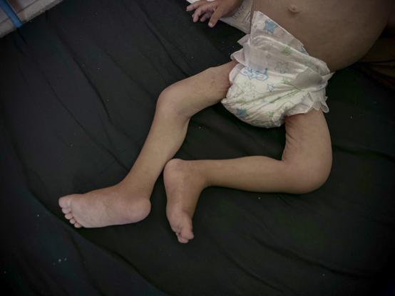 How many must die before Gaza’s famine is called a crime? - How many must die before Gaza’s famine is called a crime?