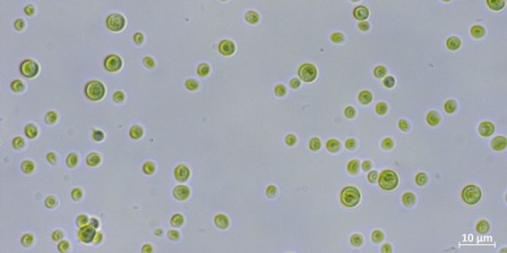 Die Alge Chlorella vulgaris unter dem Mikroskop