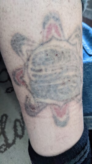 Very faded leg tattoo