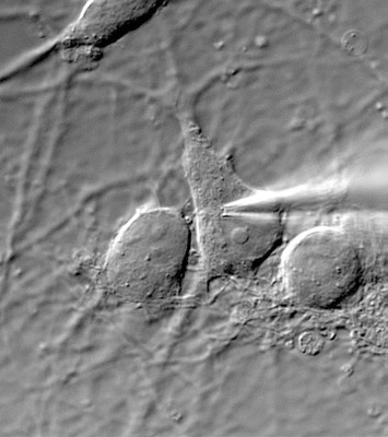 Grayscale microscope image of a cell being patch recorded by a glass pipette.