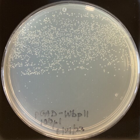Petri plate with a biased spread of bacteria to isolate single colonies.