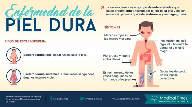 Infografía enfermedad de la piel dura. Tipos de Esclerodermia y algunos síntomas. #AltText4Me