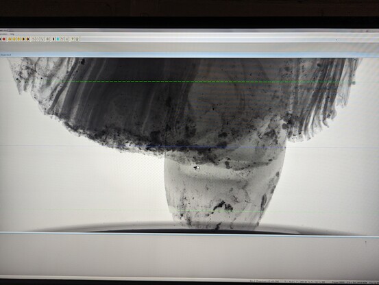 Single projection from a CT scan of an object. 
It looks a bit like a mushroom, but isn't.  