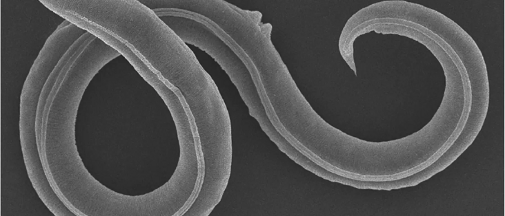 © Institute of Physicochemical and Biological Problems in Soil Science RAS/ Alexei V. Tchesunov und Anastasia Shatilovich (Ausschnitt)

Diese neu beschriebene Fadenwurmart hat wahrscheinlich zehntausende Jahre im Permafrost überlebt, bevor sie aufgetaut wurde. Danach lebte und vermehrte sie sich wieder prächtig.