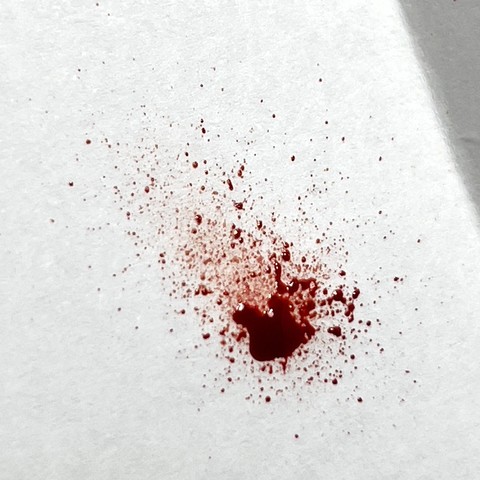 Simulated blood-spatter using paint on white paper.