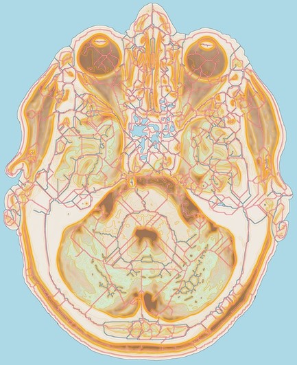 A fantasy map created from an MRI section.