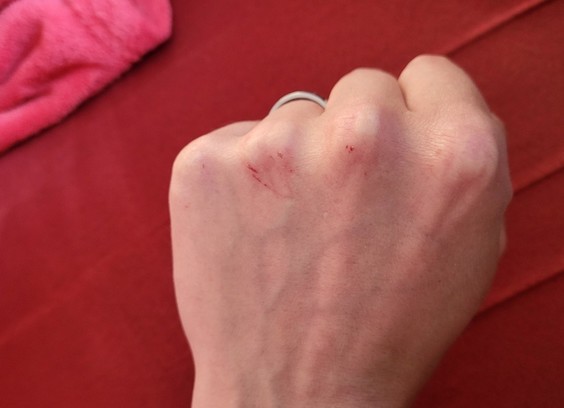 This image captures a close-up view of a clenched fist, highlighted by the vivid shades of red that dominate the scene. the fist shows scratches along the knuckles.