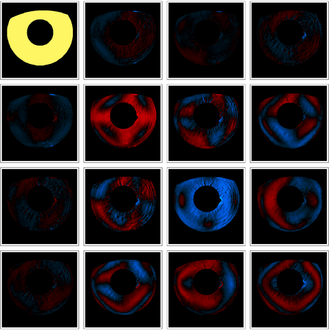 Grid of eye images