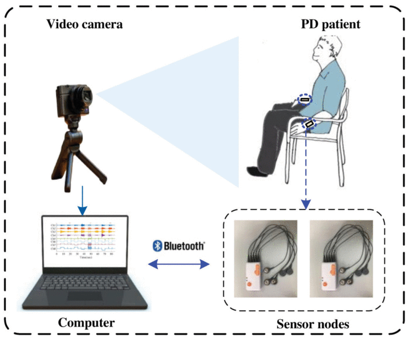 The illustration on the left shows the setup of the multi-sensor signal acquisition platform. The patient wears the sEMG (surface electromyography) electrodes on both arms. The signals are transmitted to a computer via Bluetooth. In addition, video material is recorded by a camera for evaluation. The image on the right shows the exercises that the patients had to perform during the study: a) placing their hands on the back of the chair, b) extending their arms, c) pronation/supination (turning …