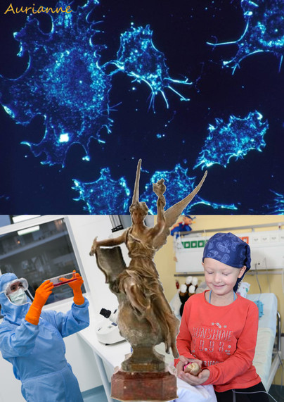 Las células del cuerpo humano tienen una vida útil de entre 2 semanas y 15 años. Para garantizar la continuidad del cuerpo humano, se duplican y luego mueren. Esto está escrito en el ADN. Las hormonas activan las funciones del ADN. En el cuerpo humano hay cien mil millones de células. Cada día, 50.000 millones de células se clonan con su ADN y mueren.
A veces se producen errores durante la duplicación del ADN. La mayoría de las veces, la nueva célula tendrá un diseño extraño al cuerpo humano y el sistema inmunitario la destruirá. El ADN puede tener un error, pero las hormonas no lo activan; no hay consecuencias. El ADN puede transcribirse incorrectamente, la célula funcionará mal, pero se reconoce como parte del cuerpo humano y se reproduce con sus defectos. Estos errores se producen 45 millones de veces al día. Eso es la vejez.
Excepcionalmente, se comete un error y la célula se olvida de morir. Se convierte en inmortal. Se clonará a sí misma y en lugar de tener una célula nueva y una que muere, habrá dos. Luego cuatro, luego dieciséis, y así sucesivamente. Esto es el cáncer. Las células funcionan mal y aumentan en número en lugar de permanecer constantes.
El cáncer es peligroso porque estas células desequilibran el cuerpo humano: demasiadas hormonas, demasiados huesos, demasiado estómago, entre otros. Cuando ocupan demasiado espacio, lo llamamos tumor. La distribución de los cánceres en la población es lineal, típica de una distribución estadísti 


