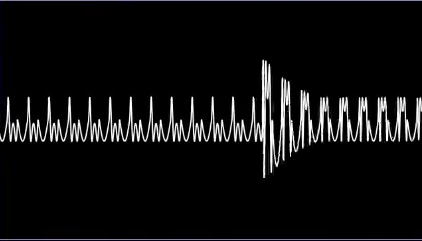 oscilloscope of an FM sound wave, attack for the new note coming in.
