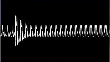 same oscilloscope, attack propagated