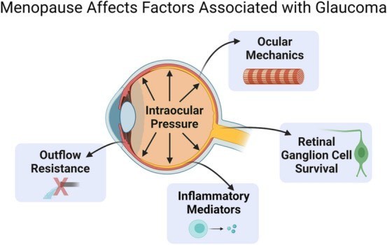 Menopause as a Sex-Specific Risk Factor for Glaucoma