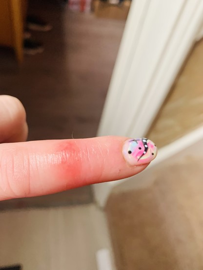 Index finger on left hand, red angry patch just above mid knuckle 